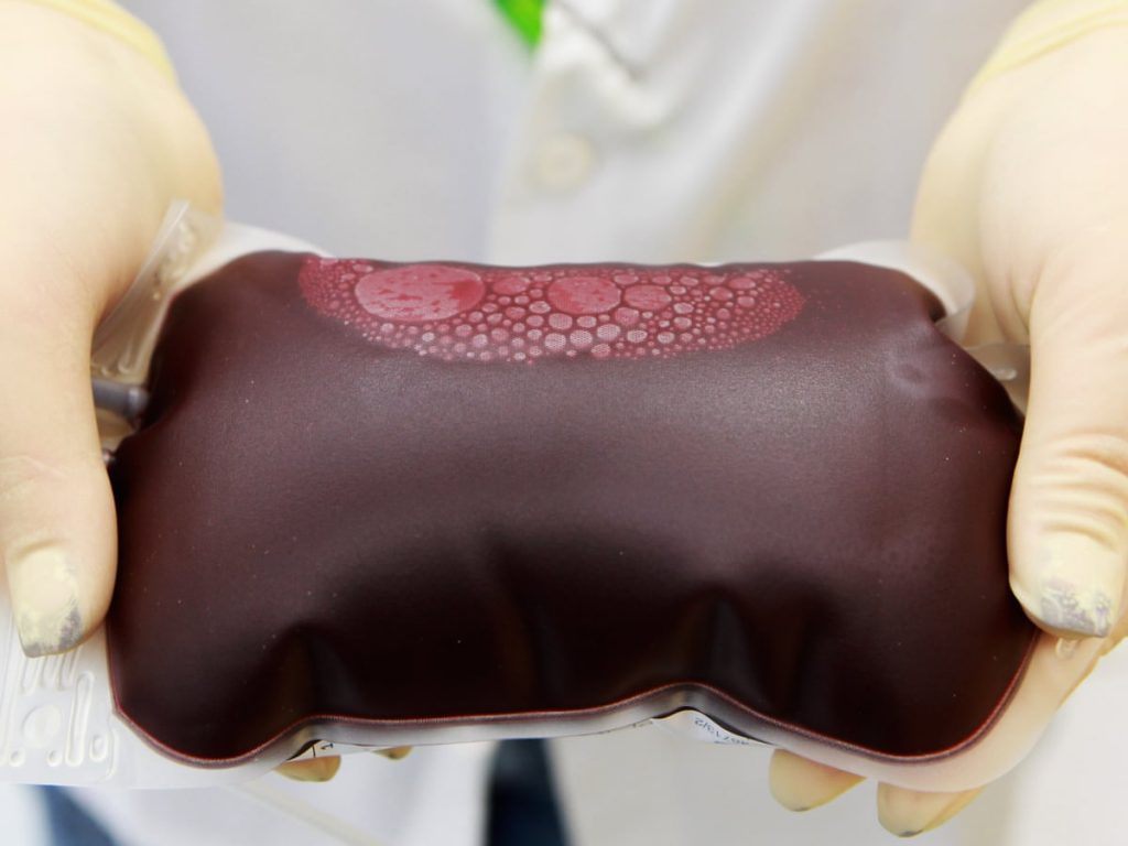 МОЗ буде приймати кров від ризикованих донорів: експерти вимагають роз’яснень і наукових підстав